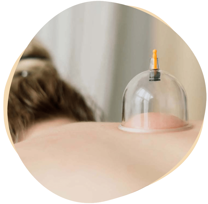 transformational cupping